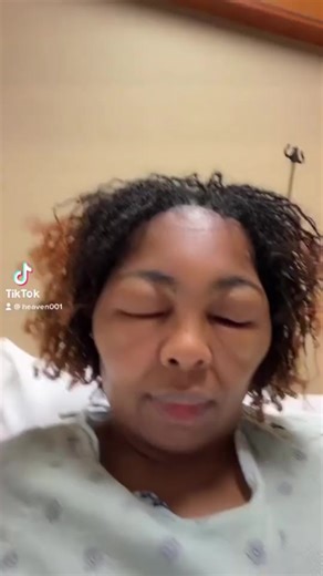 14K views · 130 reactions | Allergic reactionParaphenylenediamine (PPD) is a chemical substance that is widely used as a permanent hair dye.If you're allergic to PPD, your scalp and face may feel itchy and start to swell. PPD may also trigger symptoms throughout your body, such as itching, a nettle rash and generally feeling ill. These symptoms may not develop until hours, or even days, later. | Healthy Hair Journey | Facebook