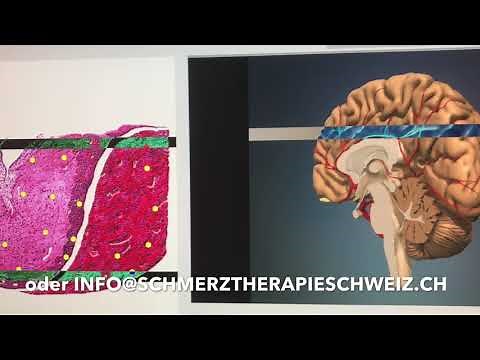 MODERNES NLS - SYSTEM ZUR DIAGNOSTIK UND THERAPIEUNTERSTÜTZUNG IM EINSATZ