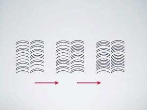 Pattern Hair Loss: Treatment Expectations