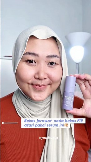 #Elsheskin Radiant Advance Serum to brighten skin and fade dark spots and acne scars