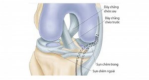 Sử dụng gân tự thân trong tạo hình dây chằng chéo khớp gối