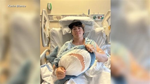 Shark attack victim recounts attack