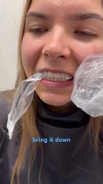 Vertical bitewings #dentist #dentalhygiene #dentalhygienestudent #dentalassistant