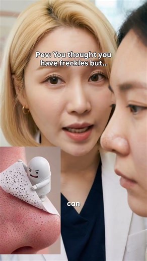 Build up inside pores should be softened first the get removed to protect pores and also remove it