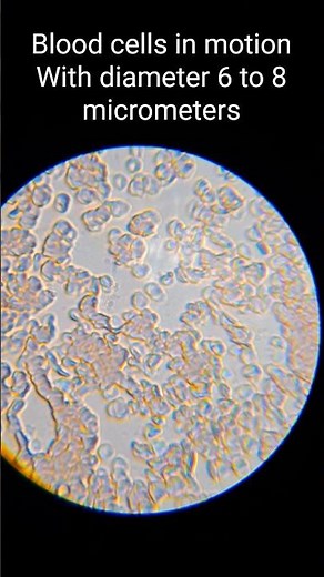 What Does Human Blood Look Like Under a Microscope?