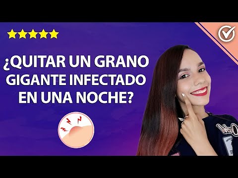 How to Remove a Giant Infected or Cystic Pimple Overnight - Under a Mole