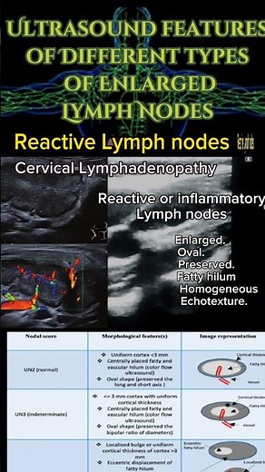 Reactive enlarged cervical Lymph Nodes #ultrasound #doctor #shortsbeta @DrSaimaKhan