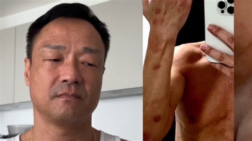 Ex TVB Actor Wong Hei Says He Was Drugged & Sexually Assaulted Twice In Taiwan Last Year