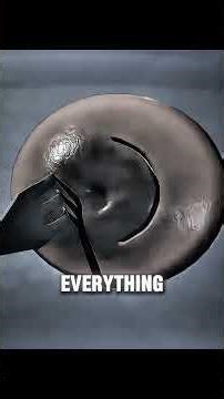 How LEEP Treats Cervical Cancer Without Major Surgery! #leepprocedure #cervicalcancer #womenshealth