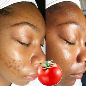 1.3K views · 12 reactions | tomato for skin benefits #skinwhite #skincare #healthtips tomatoes can help remove stubborn dark spots as well as lighten the skin to give you brighter and more even skin tone #skinglow #healthtips #skincareroutine #skinwhitening #beauty #antiaging #beauty #skincareroutine #skinwhite | Health Tips | Facebook