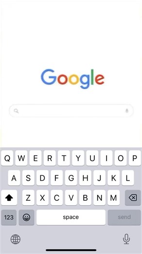 @ophthagram.thrace on Instagram: "Retinal Giant Cyst with Retinoschisis • 🧠 Retinoschisis = splitting of the neurosensory retinal layers, creating intraretinal cavities • 💧 In advanced cases, fluid accumulation within schisis layers can form a giant retinal cyst • 🔍 Appears as a smooth, dome-shaped, translucent elevation on fundus exam • 🖥️ OCT shows separation of retinal layers with large intraretinal cystic space • ⚖️ Must be differentiated from retinal detachment (schisis is immobile and 