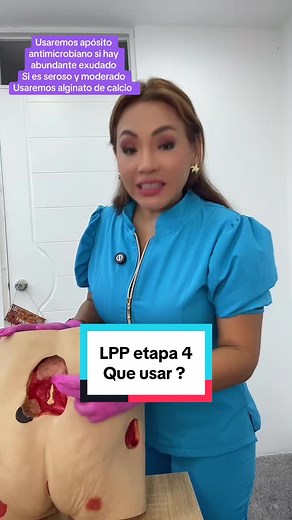 Valoración de lesiones por presión etapa 4: tratamiento