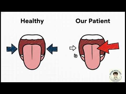 Clinical Localization of Medial Medullary Syndrome: USMLE