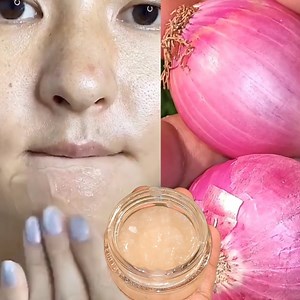 166K views · 2.2K reactions | 1 onion is a million times stronger than Botox, it eliminates wrinkles and fine lines instantly #wrinkles #antiaging #fineline #skincare #beauty #homemade #diy #hacks #glowingskin | Anmol Hindi | Facebook