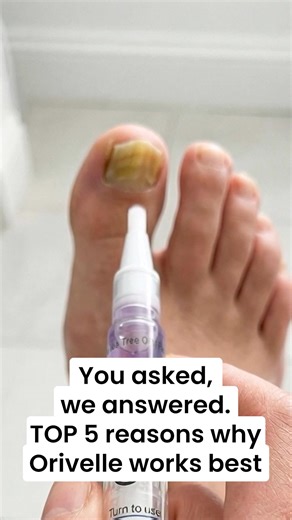 Tired of hiding your nails? 💅 Say hello to open-toe confidence in just 2 weeks. The Orivelle Nail Pen doesn't just cover up the problem—it goes deep to fight the fungus at its source. ✅ Targets the nail root ✅ Easy 10-second daily application ✅ Noticeable results in days ✅ Backed by science and a 30-day guarantee Don't wait for it to spread. Start your treatment today | Sophia Mitchell