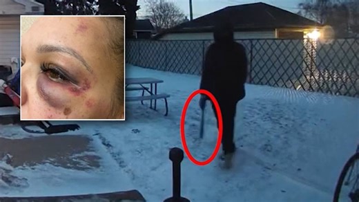 Pregnant woman attacked with baseball bat outside home, police say