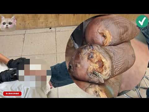 ⚠️ Extreme Jigger Infestation – Cracked Skin Peeled Off Clean! #BE143