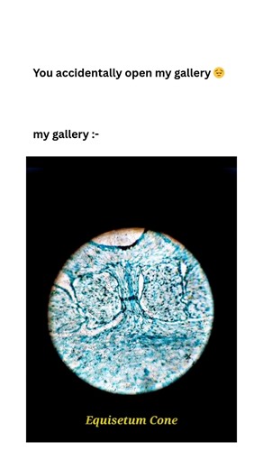 You accidentally open my gallery🧫🦠🔬 #gallery #microbiology #students #studentlife#ggv