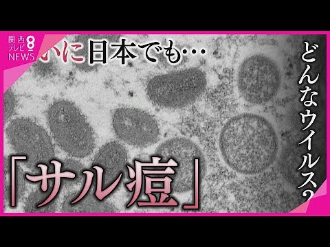 「サル痘」ってどんなウィルス？ 感染経路は？ 症状は？ 専門家がイチから解説