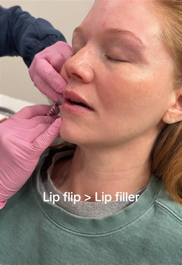 Achieve Juicy Lips with Lip Flip Technique