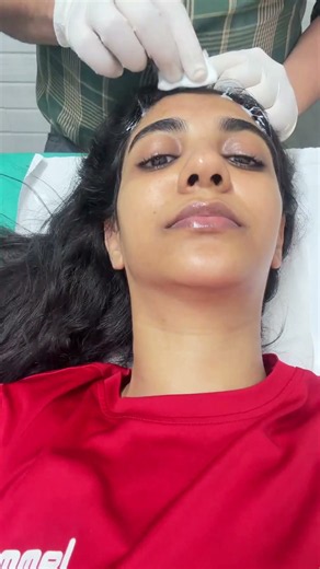 PRP for Hair Fall 😳 My Real Experience | Hair Loss Treatment #shorts