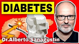 ¿Sabes qué es la diabetes?¿Sabes que tipos de diabetes hay?¿Conoces las posibles complicaciones?¿Sabes cuál es el tratemiento? En este vídeo respondo a estas preguntas y mucho más. La diabetes mellitus es un grupo de enfermedades crónicas que afectan la forma en que su cuerpo usa el azúcar en la sangre (glucosa). Teniendo en cuenta que la glucosa es un tipo de azúcar que es la principal fuente de energía para tu cuerpo, sufrir diabetes mellitus puede causar problemas de salud graves y por eso es