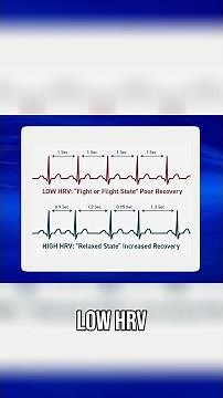 Measuring Heart Rate Variability to Treat Tinnitus