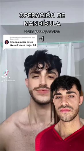 Proceso de recuperación post cirugía maxilofacial: Antes y después