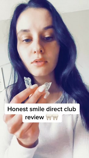 Honest Smile Direct Club Review: My Experience with Invisible Braces