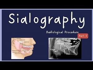 Sialography Complete Procedure (Part 2)