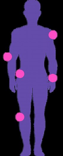 Autologous Protein Solution Therapy (APS) for Osteoarthritis | Beyond Biologics