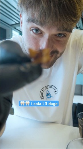 Lægger tænder i Cola i 3 DAGE👀🦷 #ultranyt