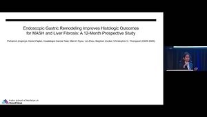Comprehensive Review of Endoscopic Sleeve Gastroplasty (ESG)