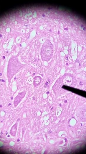 ¿Cuerpos dentro de una neurona? -Corpúsculos de Nissl- #histologia #estudiantesdemedicin #medula