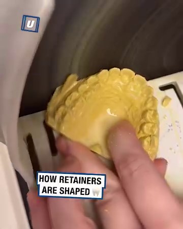 This is how teeth retainers are made! 🦷 | UNILAD Tech