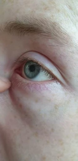 Eye Gunk Pulls - 🍏 "cooooorrrre" 🍏