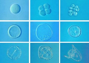 Reproduction/Development