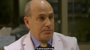 How Do You Narrow A Nose with Rhinoplasty?