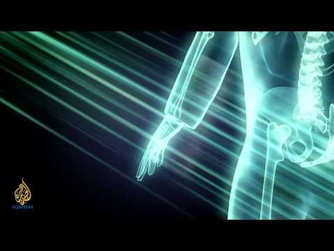 The Cure - Medical Pioneer: Wilhelm Roentgen