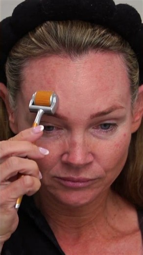 How I Numb My Face Before Microneedling (My Complete Routine)