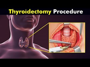 How is Total Thyroidectomy Performed? Procedure, Reasons, and Aftercare