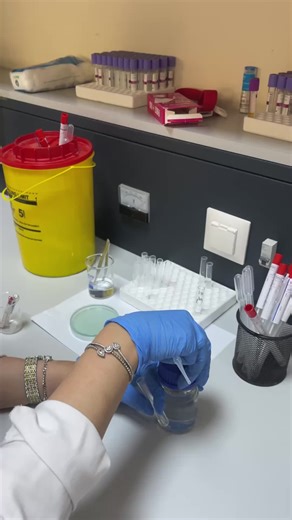 Kirby-Bauer Disk Diffusion Procedure for Fungi