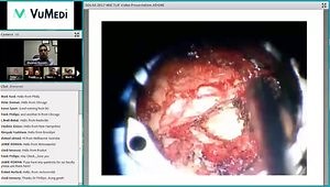 Overview of MIS TLIF Technique