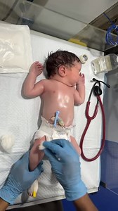 4.2K views · 55 reactions | Newborn baby #newbornbaby #newborn #FirstAid | Neonatal Care | Facebook