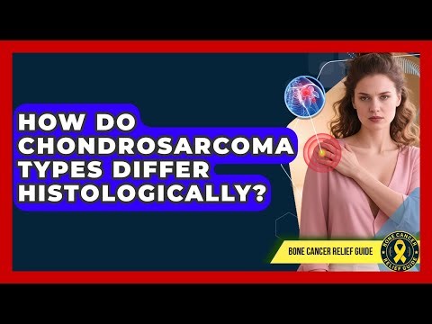 How Do Chondrosarcoma Types Differ Histologically? - Bone Cancer Relief Guide