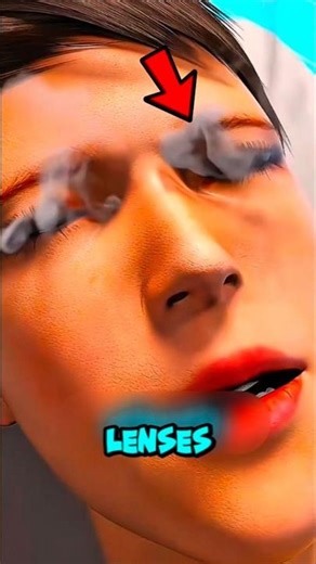 Do You Sleep With Contact Lenses? 😳 Here’s the SHOCKING Truth Eye Doctors Won’t Ignore! #Shorts