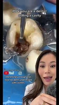 Dentist drills a massive cavity. #cavity #drillandfill #filling #dentist #rootcanal #crown
