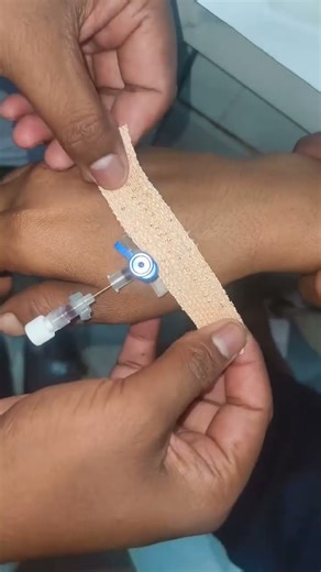 how to insert cannula doctor technique short video #cannulation #hospital #