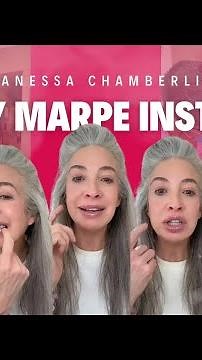 Got my Marpe expander installed today!