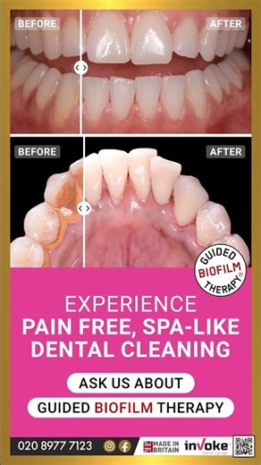Hygienist GBT - inVoke
